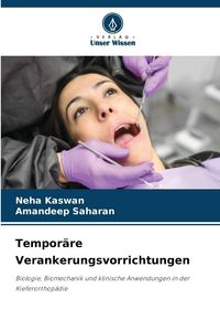 Produktbild: Tempor&auml;re Verankerungsvorrichtungen