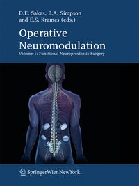 Produktbild: Operative Neuromodulation