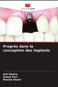 Produktbild: Progr&egrave;s dans la conception des implants