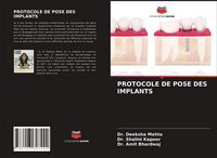 Produktbild: Protocole De Pose des Implants