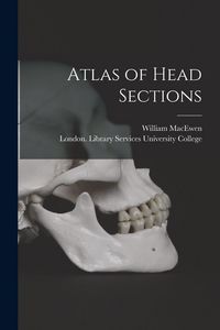 Produktbild: Atlas of Head Sections [electronic Resource]