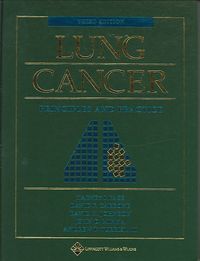 Produktbild: A Lung Cancer: Principles and Practice