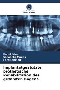 Produktbild: Implantatgest&uuml;tzte prothetische Rehabilitation des gesamten Bogens