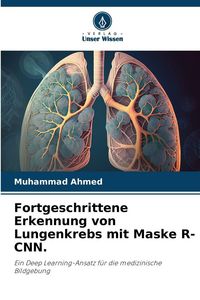 Produktbild: Fortgeschrittene Erkennung von Lungenkrebs mit Maske R-CNN.