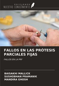 Produktbild: Fallos En Las Pr&oacute;tesis Parciales Fijas