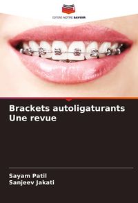 Produktbild: Brackets autoligaturants Une revue