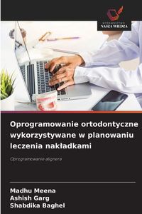 Produktbild: Oprogramowanie ortodontyczne wykorzystywane w planowaniu leczenia nak&iquest;adkami