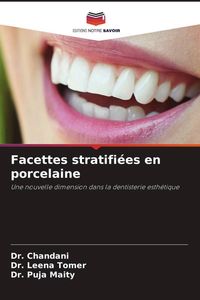 Produktbild: Facettes stratifi&eacute;es en porcelaine