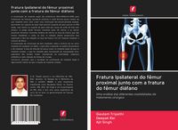 Produktbild: Fratura Ipsilateral do f&ecirc;mur proximal junto com a fratura do f&ecirc;mur di&aacute;fano