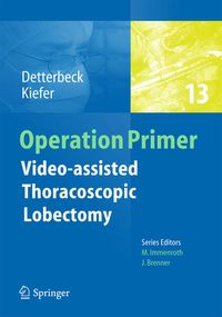 Produktbild: Video - assisted Thoracoscopic Lobectomy