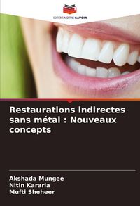 Produktbild: Restaurations indirectes sans m&eacute;tal : Nouveaux concepts