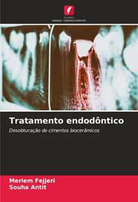 Produktbild: Tratamento endod&ocirc;ntico