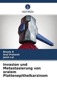 Produktbild: Invasion und Metastasierung von oralem Plattenepithelkarzinom