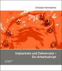 Produktbild: Implantate und Zahnersatz - Ein Arbeitsskript