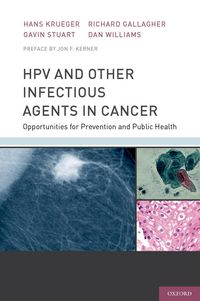 Produktbild: HPV and Other Infectious Agents in Cancer