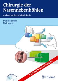 Produktbild: Chirurgie der Nasennebenh&ouml;hlen