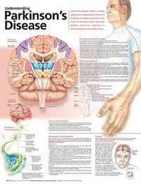Produktbild: Understanding Parkinsons Disea