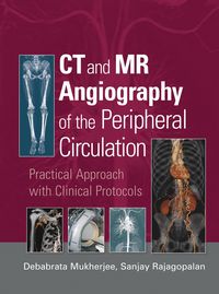 Produktbild: CT and MR Angiography of the Peripheral Circulation