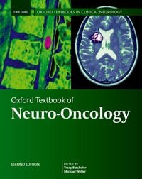Produktbild: Oxford Textbook of Neuro-Oncology