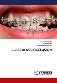 Produktbild: Class Iii Malocclusion