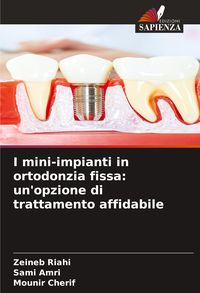 Produktbild: I mini-impianti in ortodonzia fissa: un'opzione di trattamento affidabile