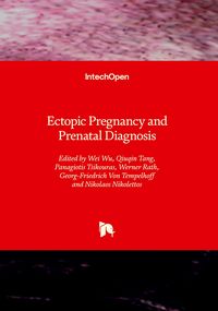 Produktbild: Ectopic Pregnancy and Prenatal Diagnosis