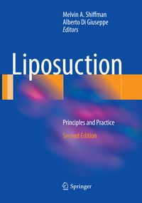 Produktbild: Liposuction