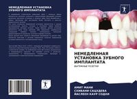 Produktbild: Nemedlennaya Ustanovka Zubnogo Implantata
