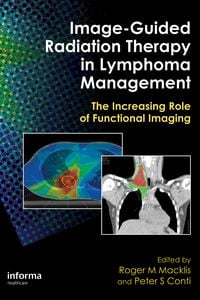 Produktbild: Image-Guided Radiation Therapy in Lymphoma Management