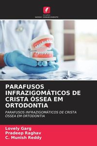 Produktbild: Parafusos Infrazigom&aacute;ticos De Crista &Oacute;ssea Em Ortodontia
