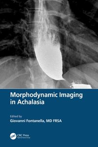 Produktbild: Morphodynamic Imaging in Achalasia