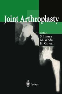 Produktbild: Joint Arthroplasty