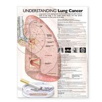 Produktbild: Understanding Lung Cancer Anat