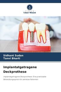 Produktbild: Implantatgetragene Deckprothese
