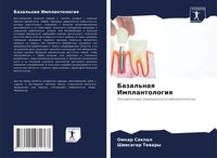 Produktbild: Bazal'naq Implantologiq