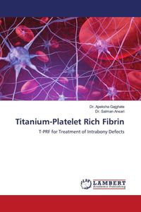 Produktbild: Titanium-Platelet Rich Fibrin