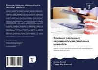 Produktbild: Vliqnie razlichnyh keramicheskih i smolqnyh cementow