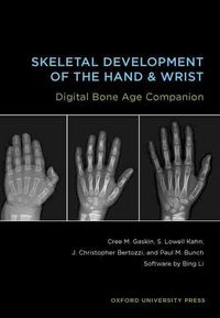 Produktbild: Skeletal Development of the Hand and Wrist: A Radiographic Atlas and Digital Bone Age Companion