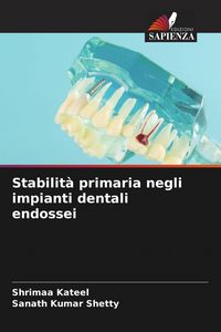 Produktbild: Stabilit&agrave; primaria negli impianti dentali endossei