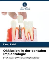 Produktbild: Okklusion in der dentalen Implantologie