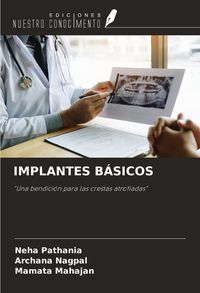 Produktbild: Implantes B&aacute;sicos