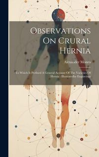 Produktbild: Observations On Crural Hernia