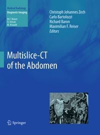 Produktbild: Multislice-CT of the Abdomen