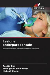 Produktbild: Lesione endo/parodontale