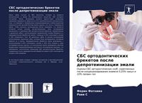 Produktbild: SBS ortodonticheskih breketow posle deproteinizacii &auml;mali