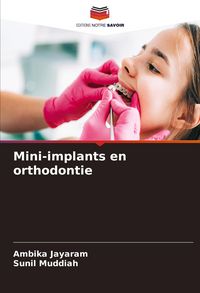 Produktbild: Mini-implants en orthodontie
