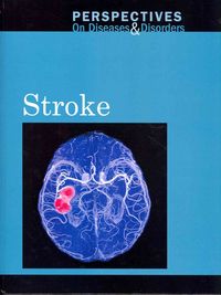 Produktbild: Stroke