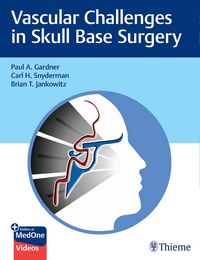 Produktbild: Vascular Challenges in Skull Base Surgery