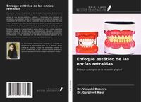 Produktbild: Enfoque est&eacute;tico de las enc&iacute;as retra&iacute;das