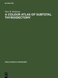 Produktbild: A Colour Atlas of Subtotal Thyroidectomy